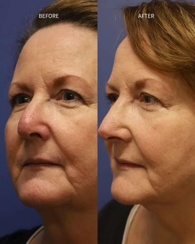 Before and after: Dr. Daniel Bortnick