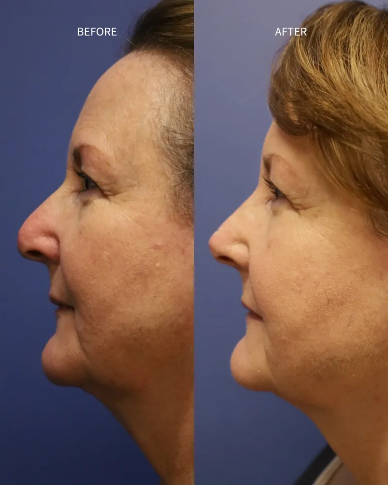 Before and after: Dr. Daniel Bortnick