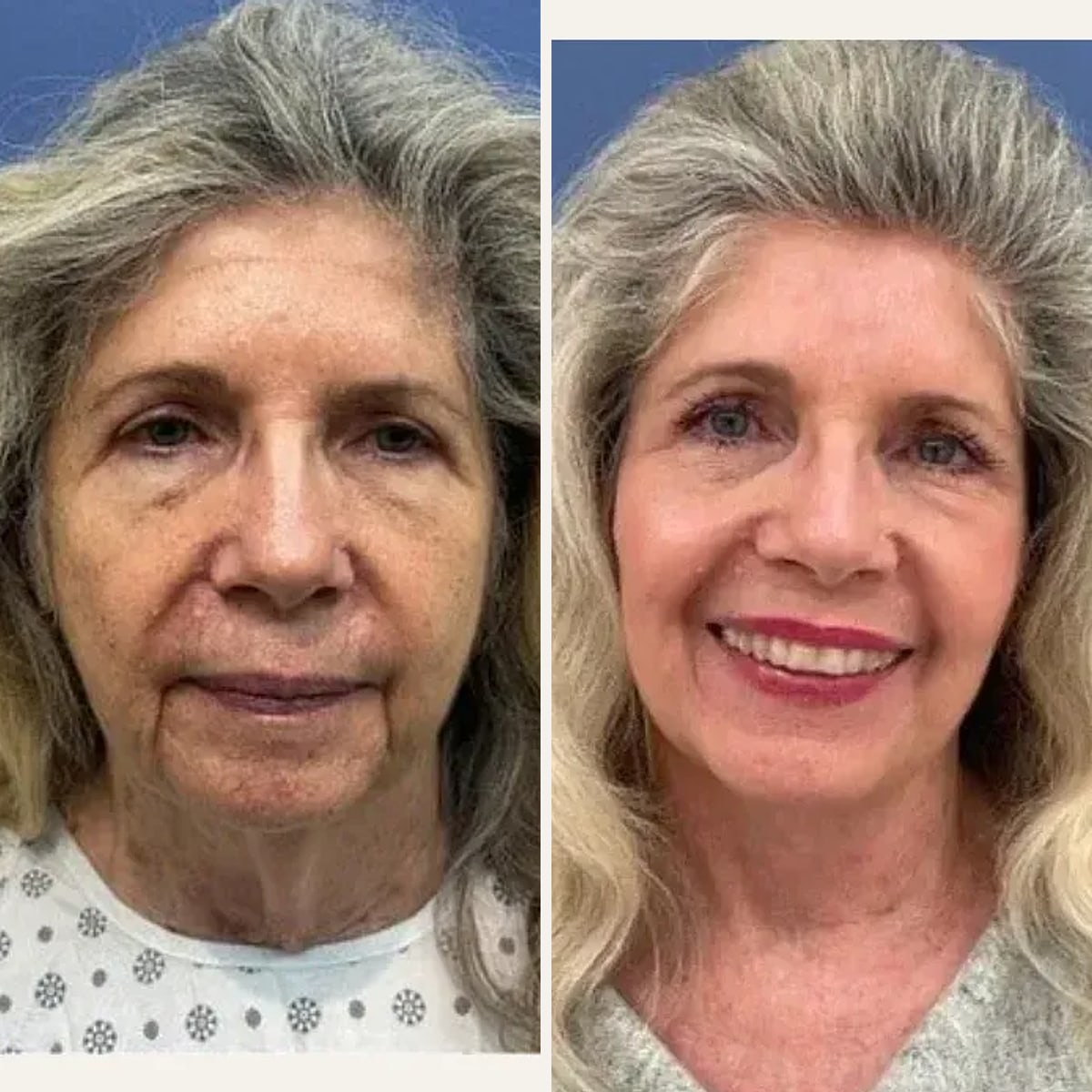 Before and after: Dr. Daniel Golshani