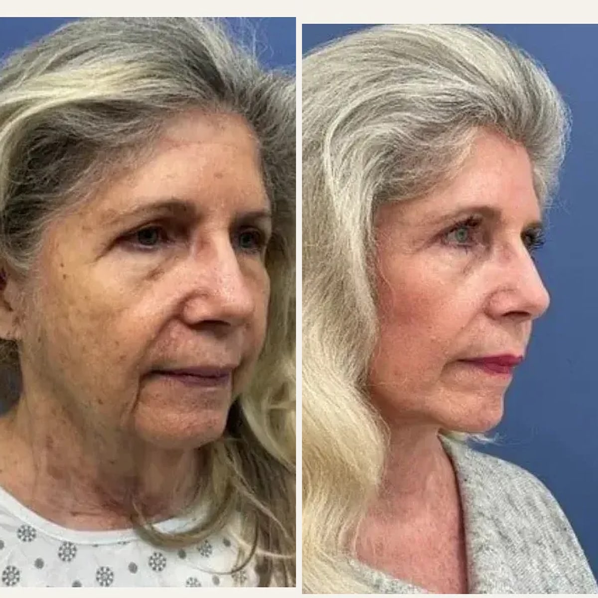 Before and after: Dr. Daniel Golshani
