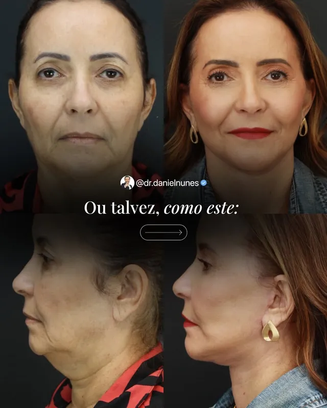 Before and after — Dr. Daniel Nunes