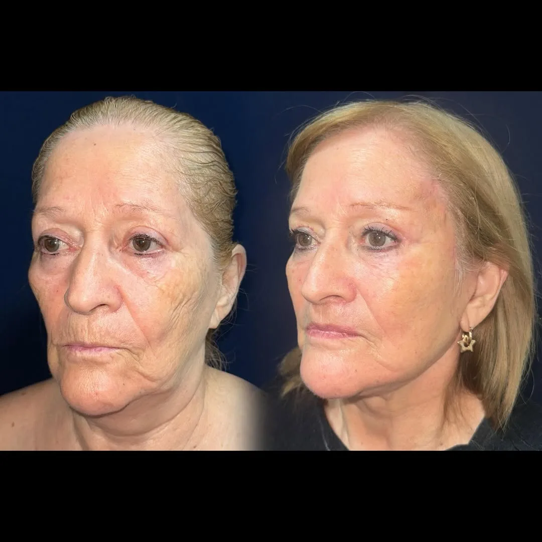 Before and after — Dr. Daniel Postan