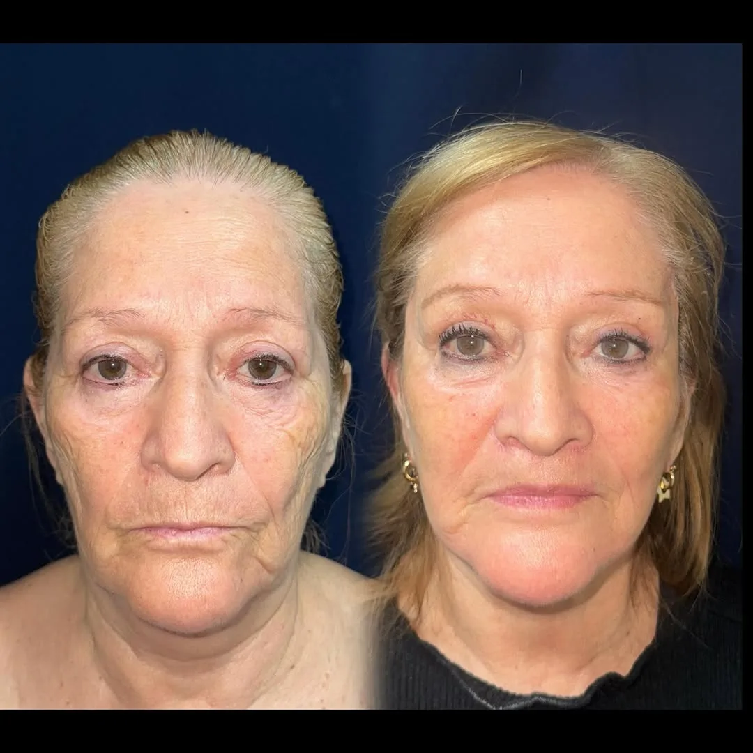 Before and after — Dr. Daniel Postan