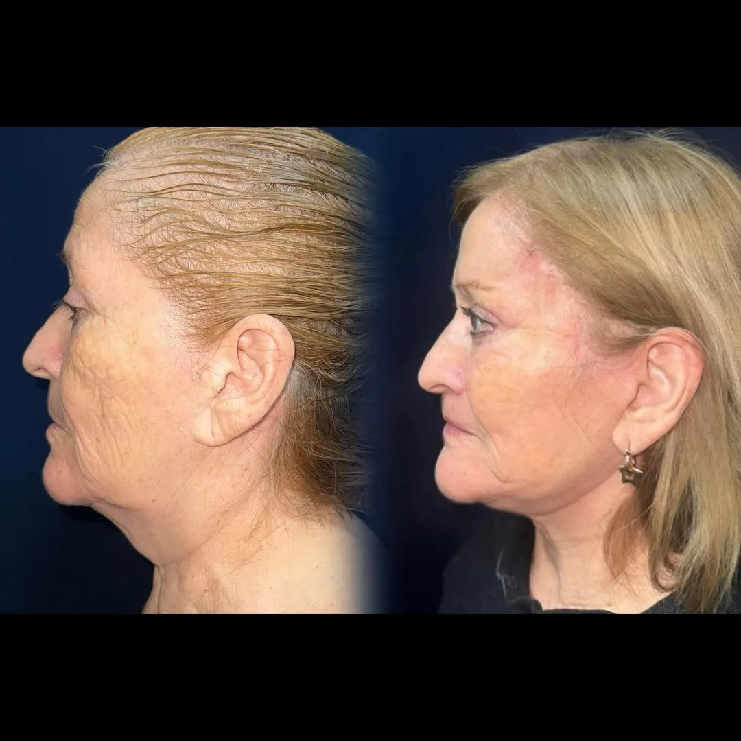 Before and after — Dr. Daniel Postan