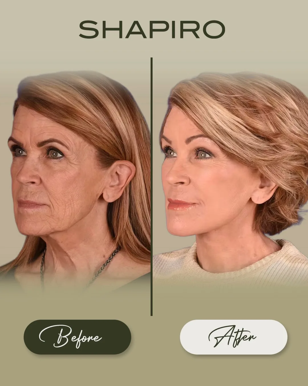 Before and after — Dr. Daniel Shapiro