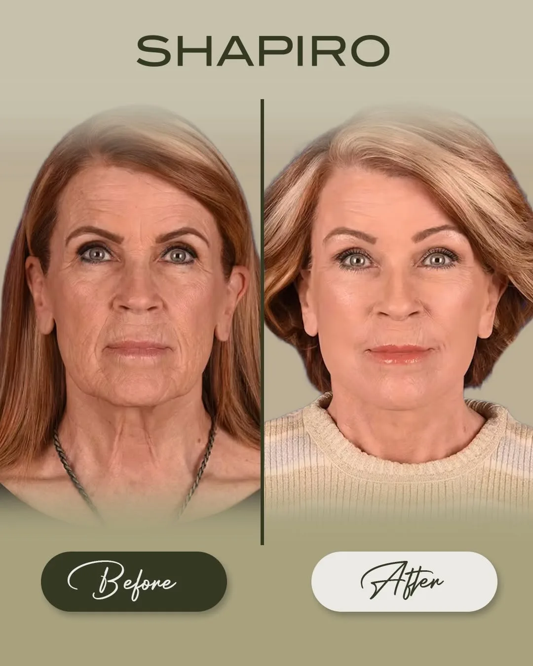 Before and after — Dr. Daniel Shapiro
