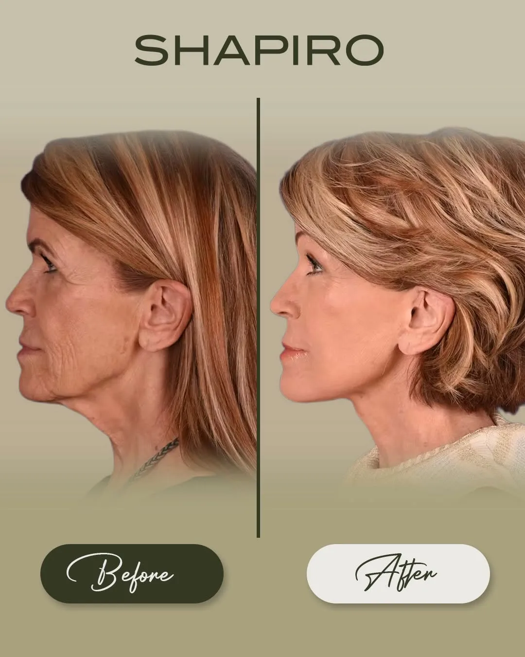 Before and after — Dr. Daniel Shapiro