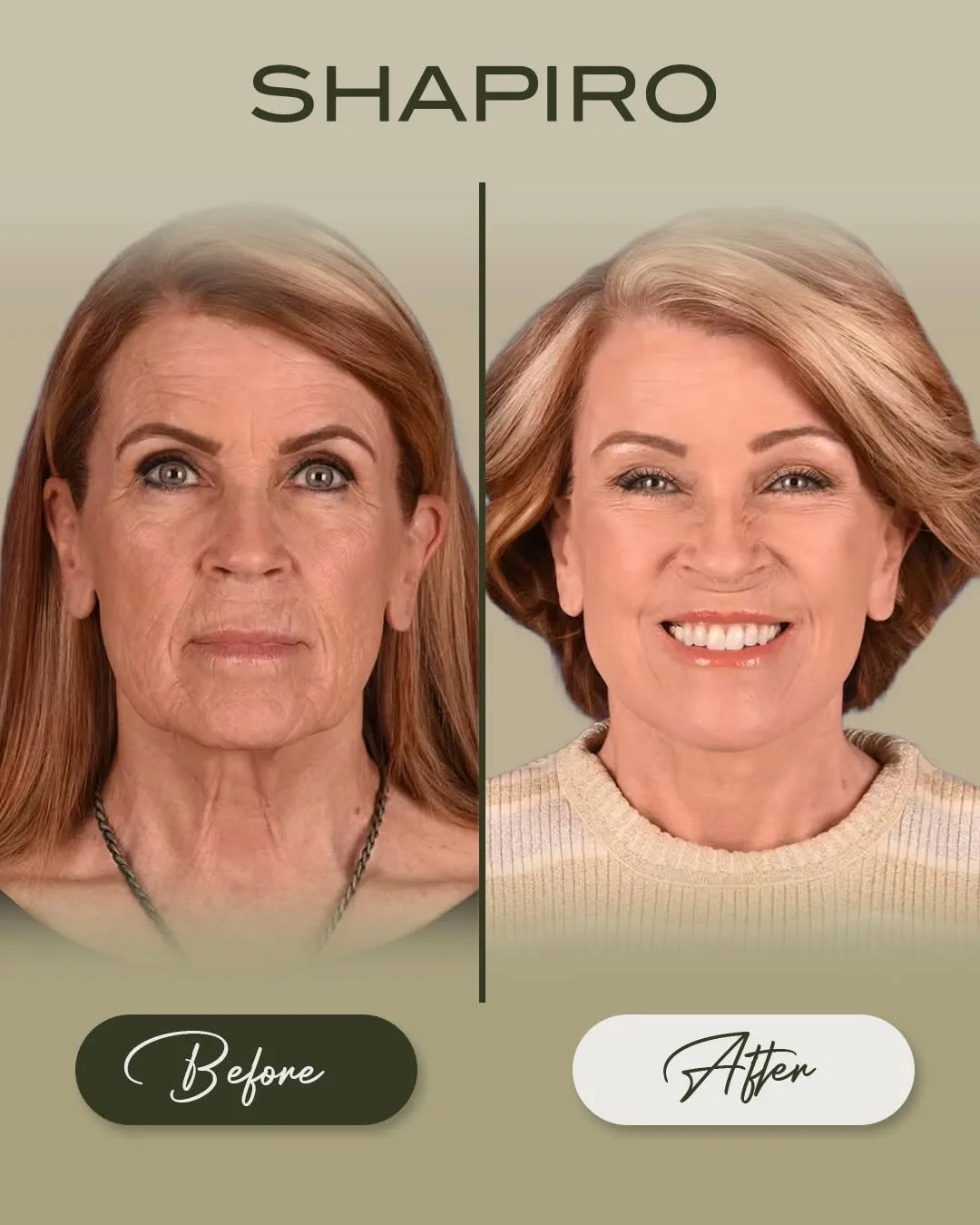 Before and after — Dr. Daniel Shapiro