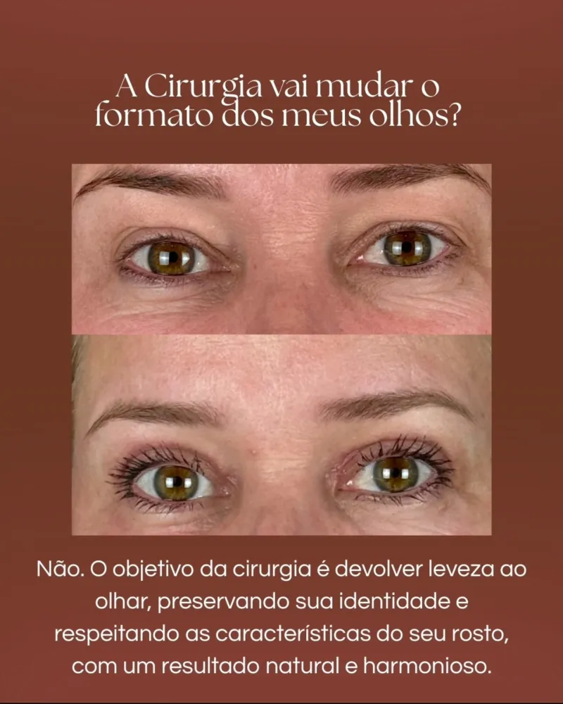 Before and after: Dr. Danielle Salvati