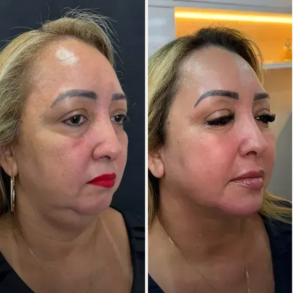 Before and after: Dr. Danillo Marinho