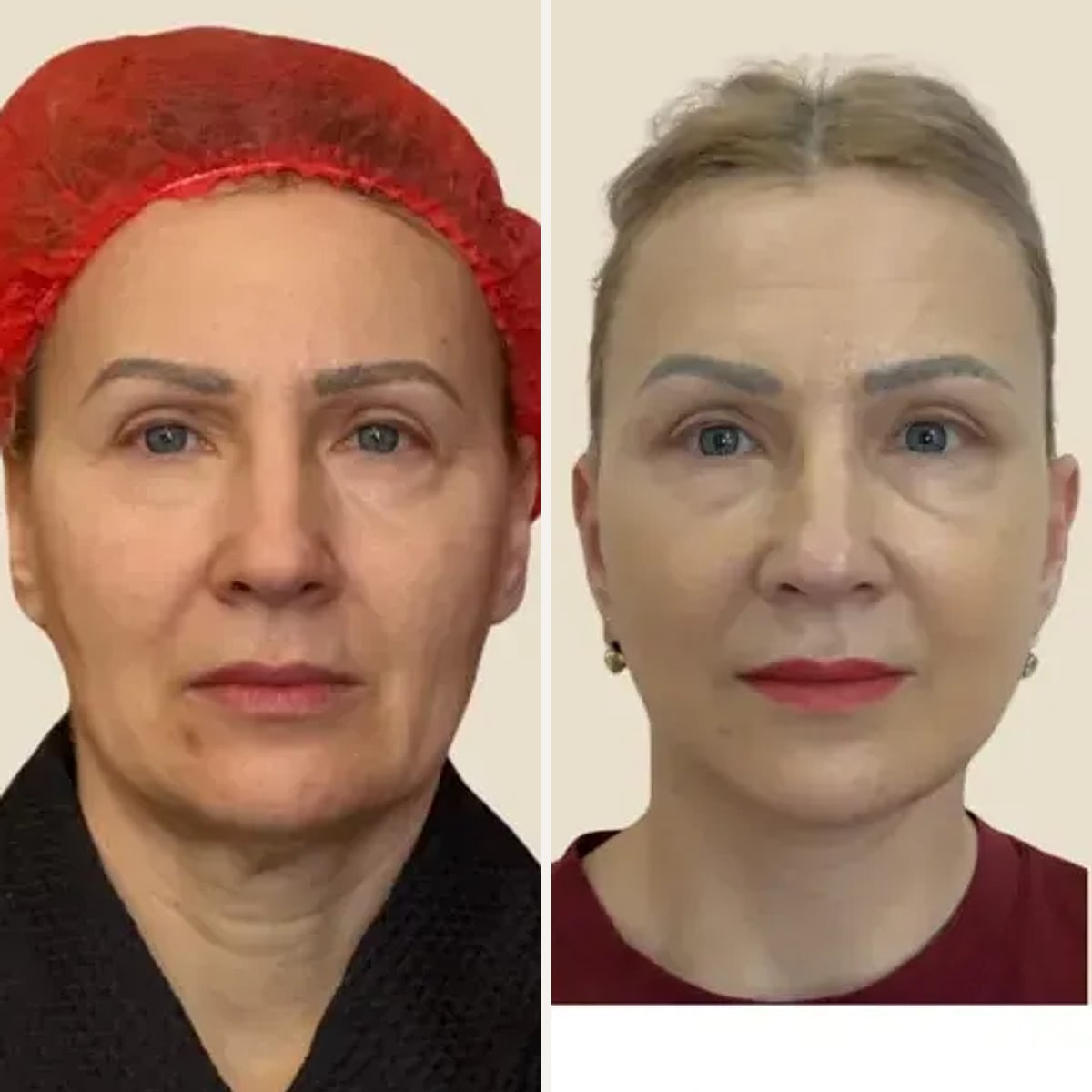 Before and after: Dr. Darina Oravcová