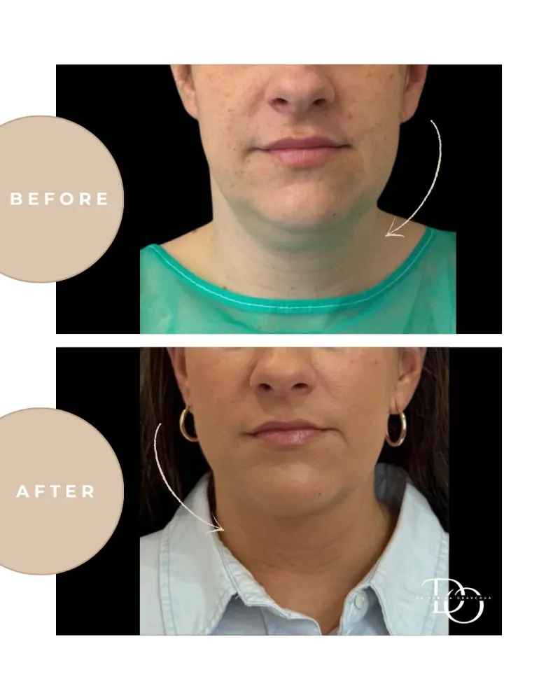 Before and after: Dr. Darina Oravcová
