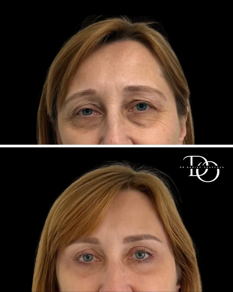 Before and after: Dr. Darina Oravcová