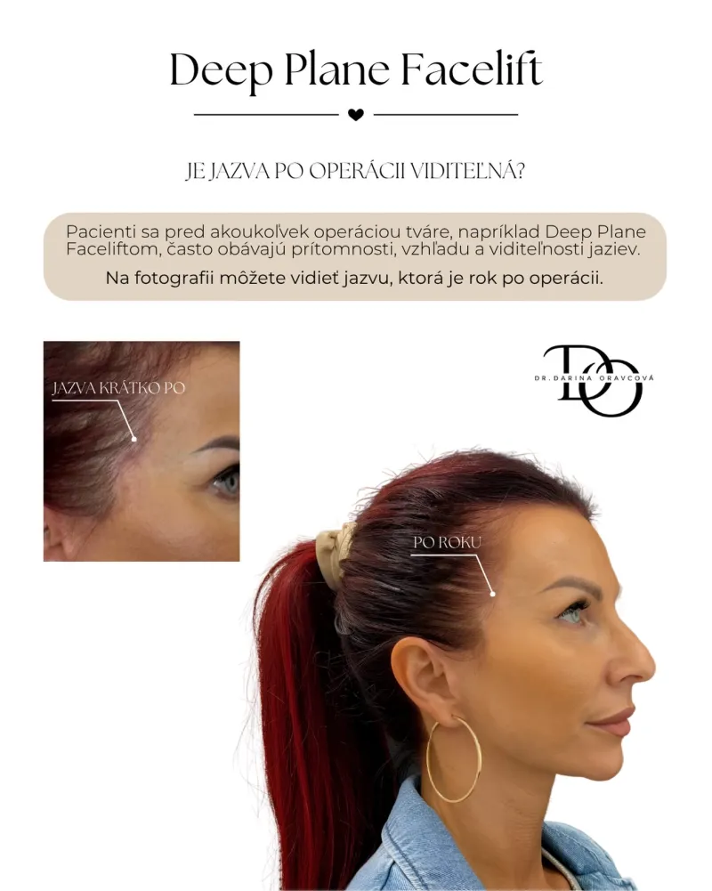 Before and after: Dr. Darina Oravcová