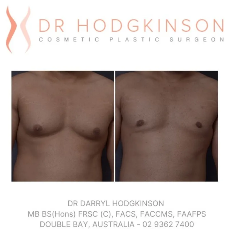 Before and after — Dr. Darryl Hodgkinson