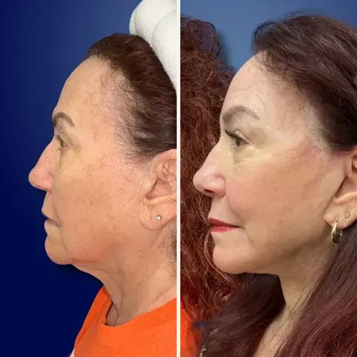 Before and after: Dr. David Funt