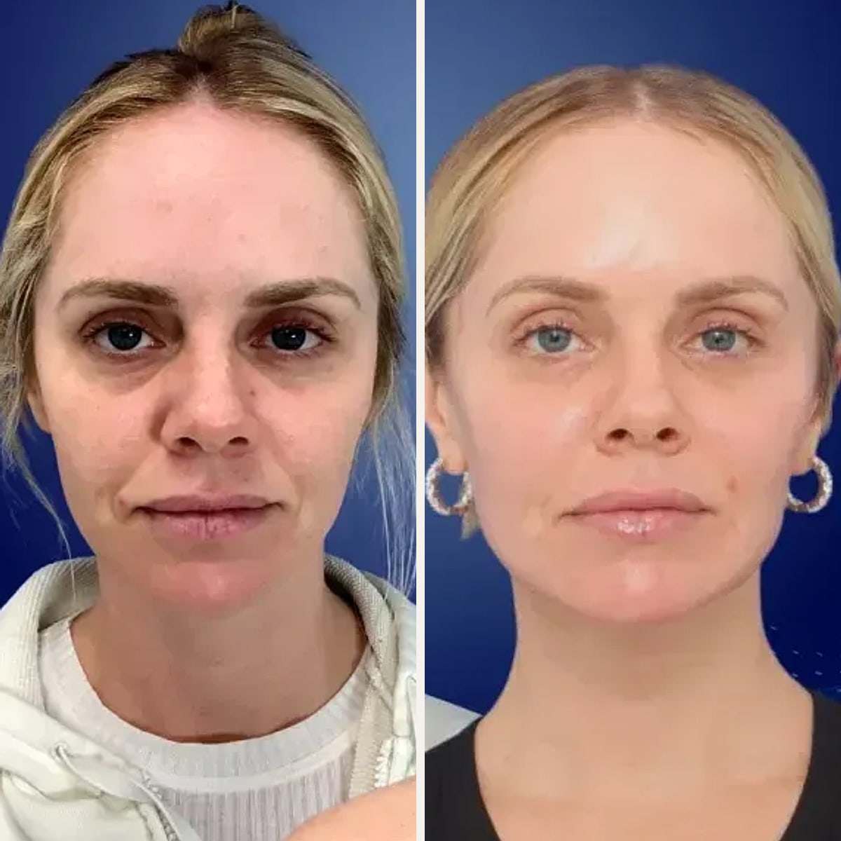 Before and after: Dr. David Funt