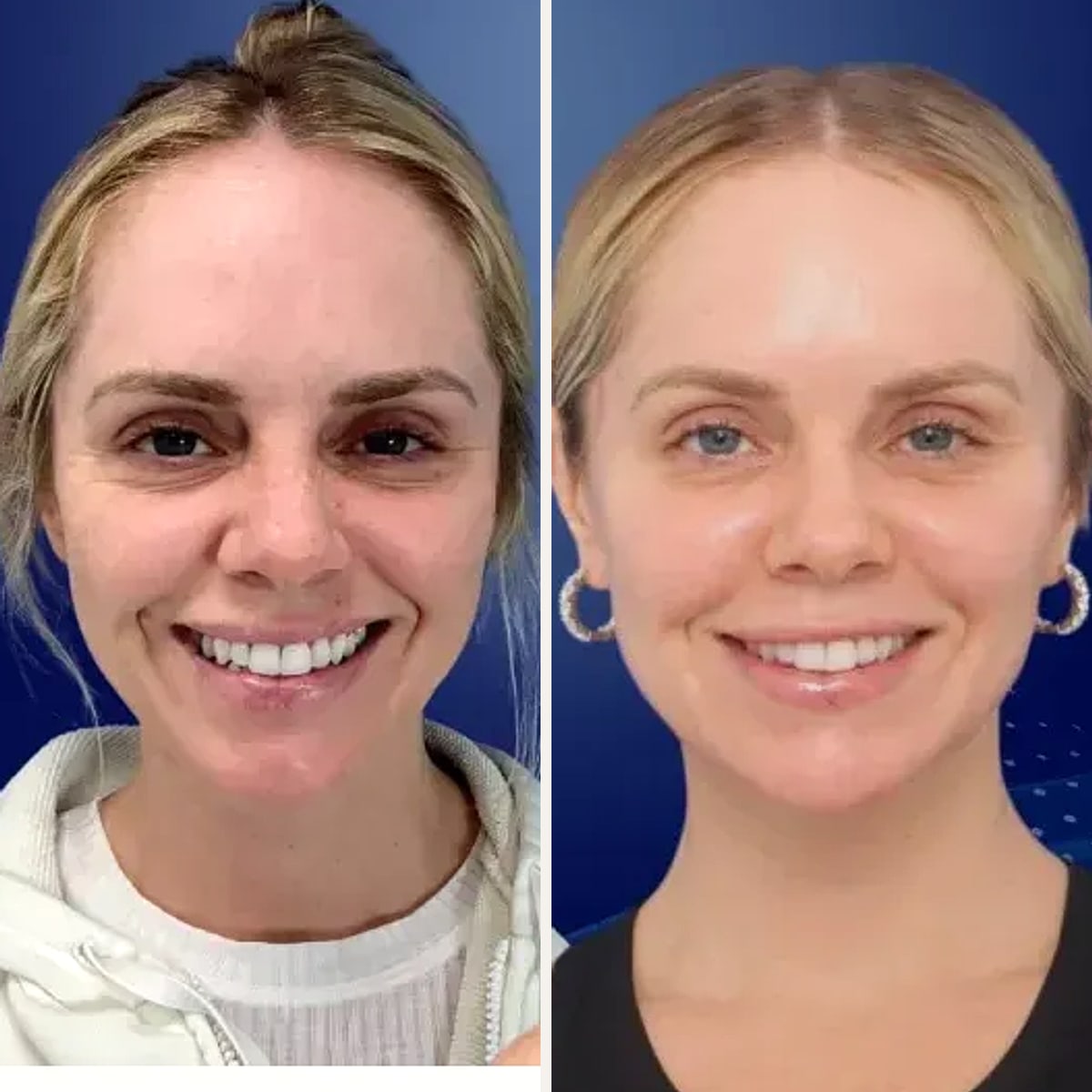 Before and after: Dr. David Funt