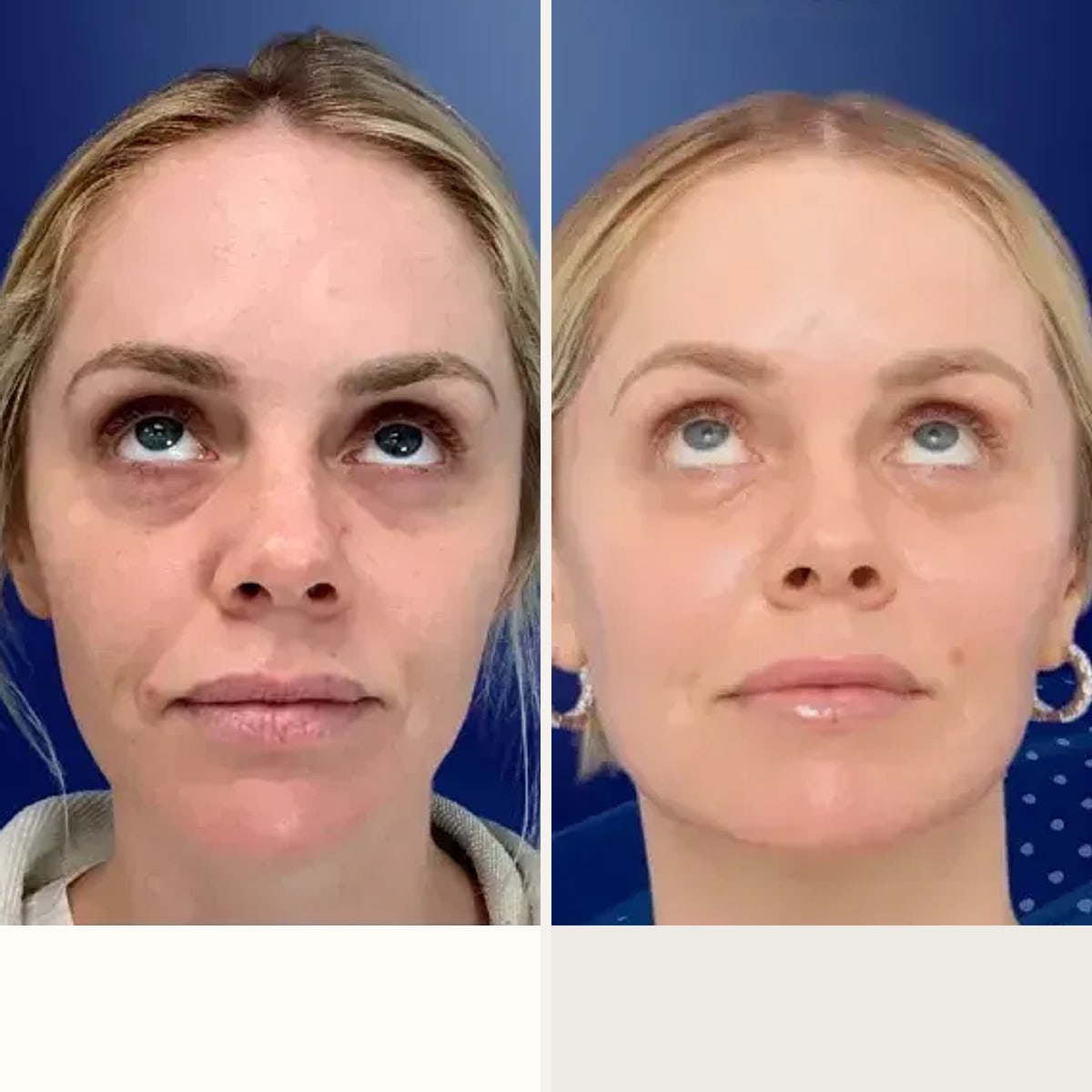 Before and after: Dr. David Funt