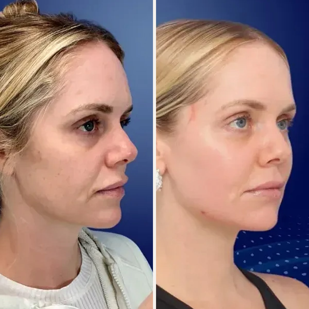 Before and after: Dr. David Funt