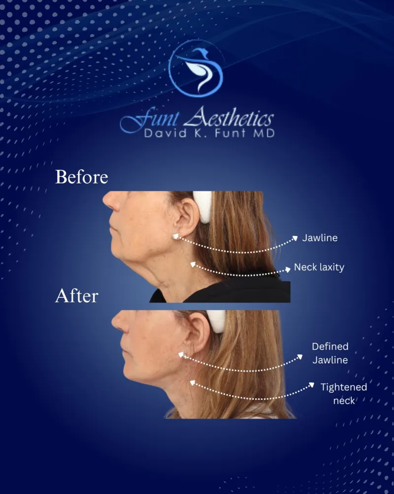 Before and after — Dr. David Funt
