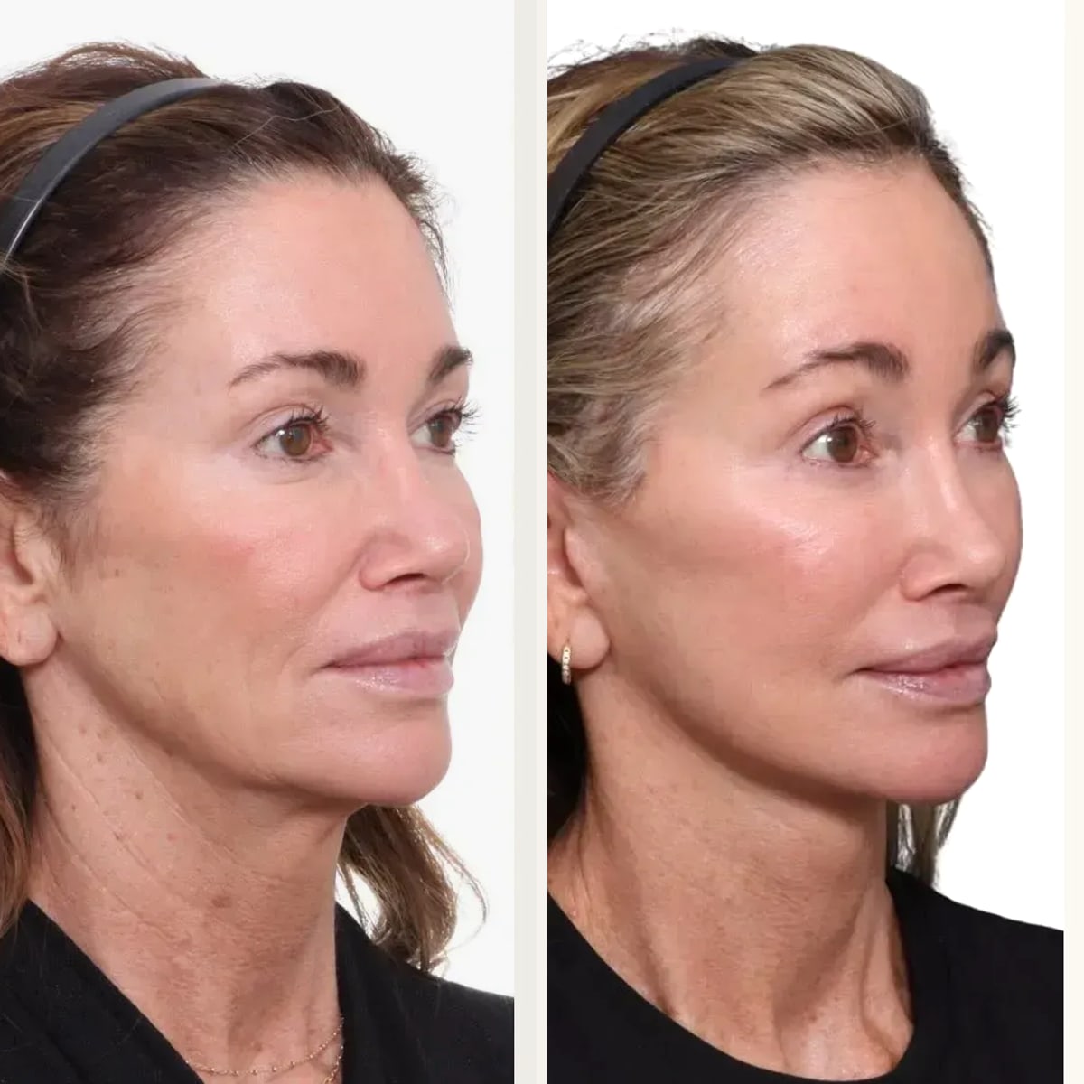 Before and after: Dr. David Gilpin