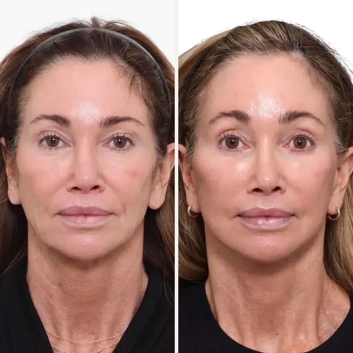 Before and after: Dr. David Gilpin