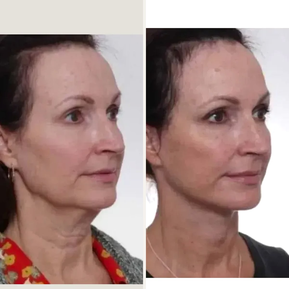 Before and after: Dr. David Gilpin