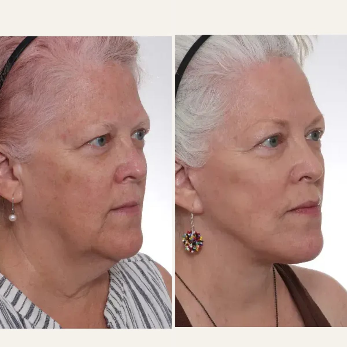 Before and after: Dr. David Gilpin