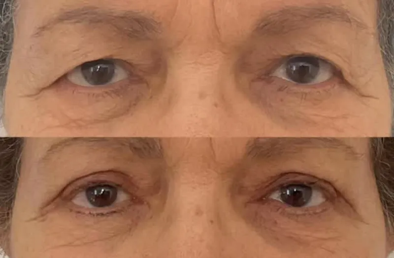 Before and after — Dr. David Gonnelli