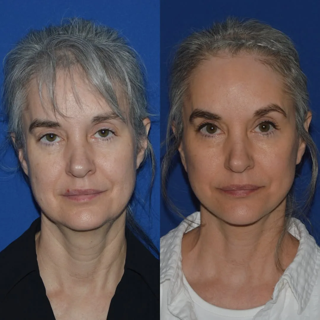 Before and after — Dr. David Harley