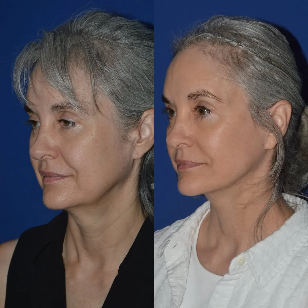 Before and after — Dr. David Harley