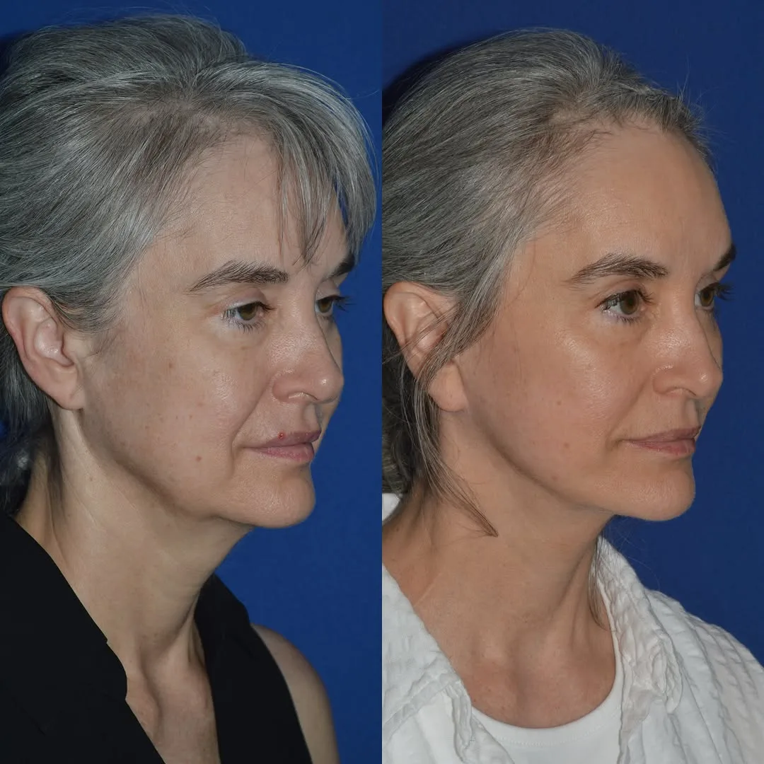 Before and after — Dr. David Harley