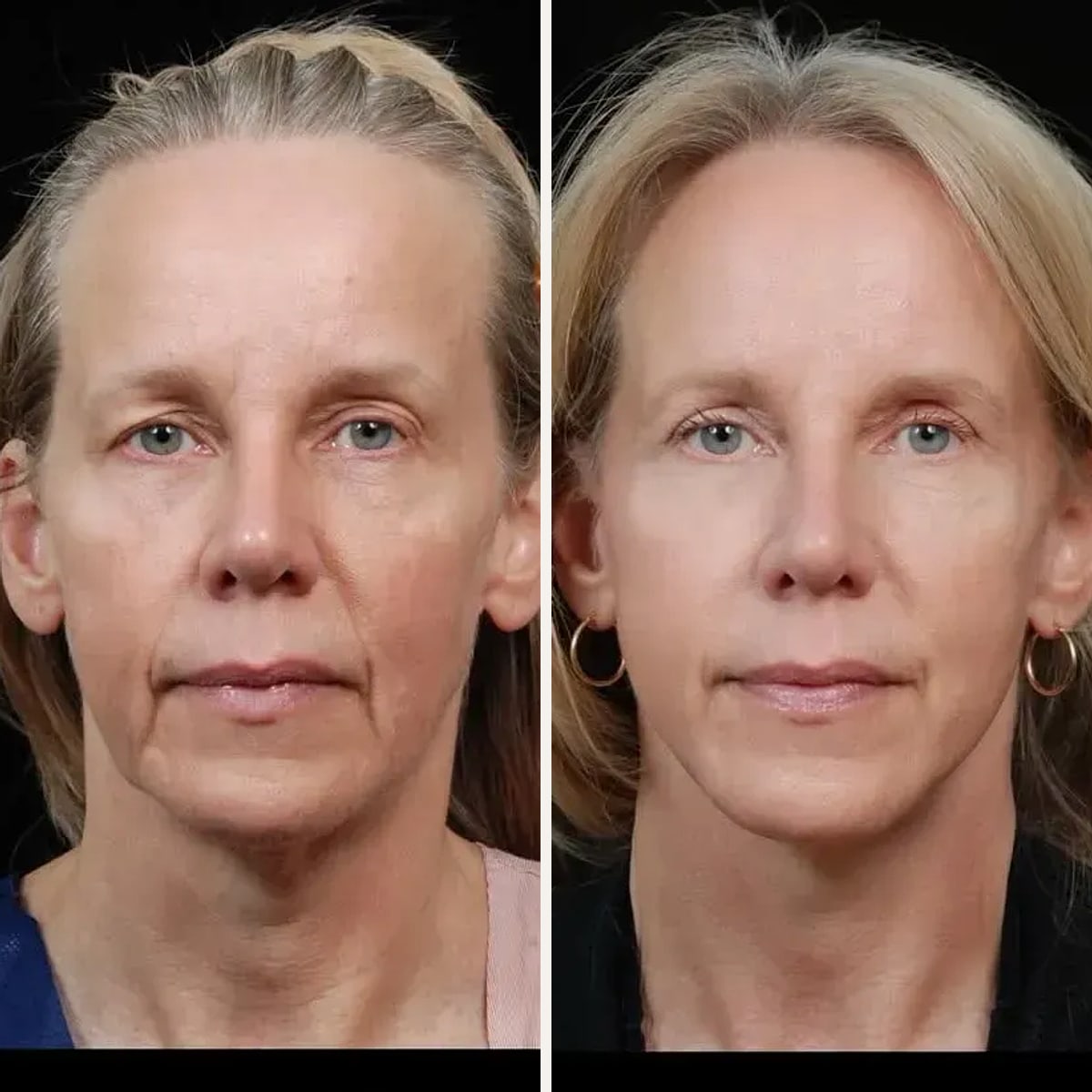 Before and after: Dr. David Hidalgo