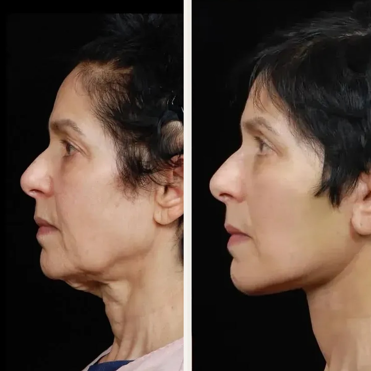 Before and after: Dr. David Hidalgo