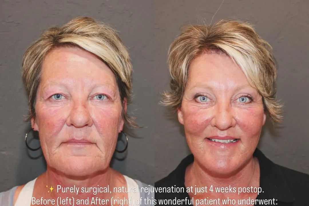 Before and after — Dr. David Ho Huan