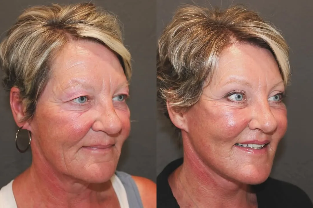 Before and after — Dr. David Ho Huan