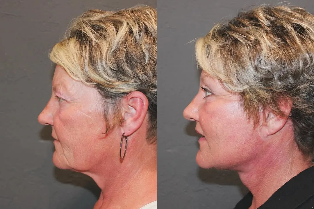 Before and after — Dr. David Ho Huan