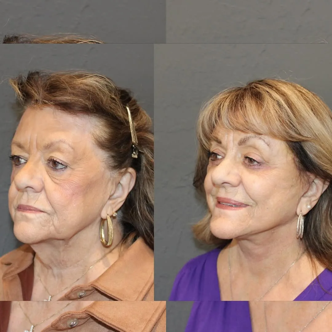 Before and after — Dr. David Ho Huan