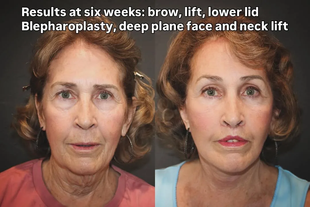 Before and after — Dr. David Ho Huan