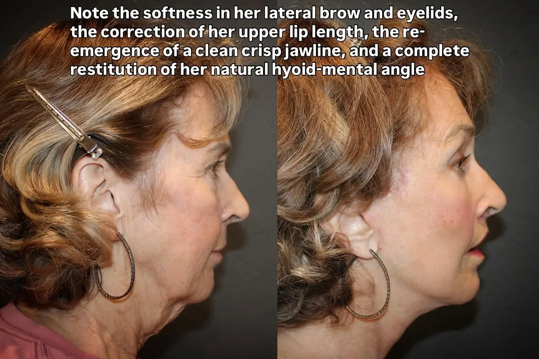 Before and after — Dr. David Ho Huan