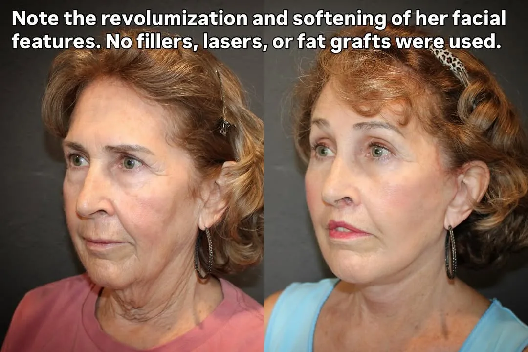 Before and after — Dr. David Ho Huan