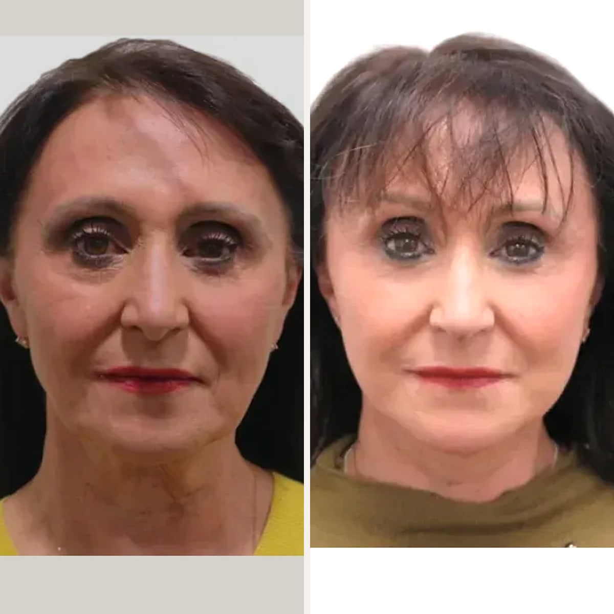 Before and after: Dr. David J. Just