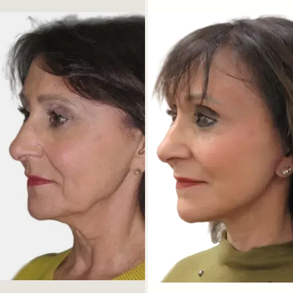 Before and after: Dr. David J. Just