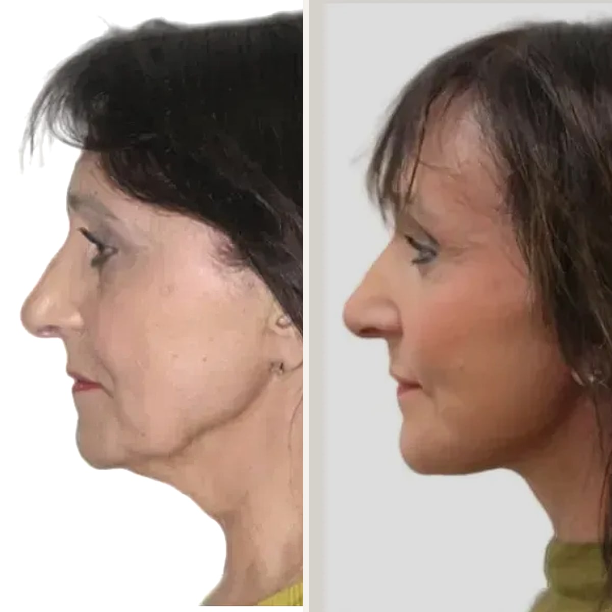 Before and after: Dr. David J. Just
