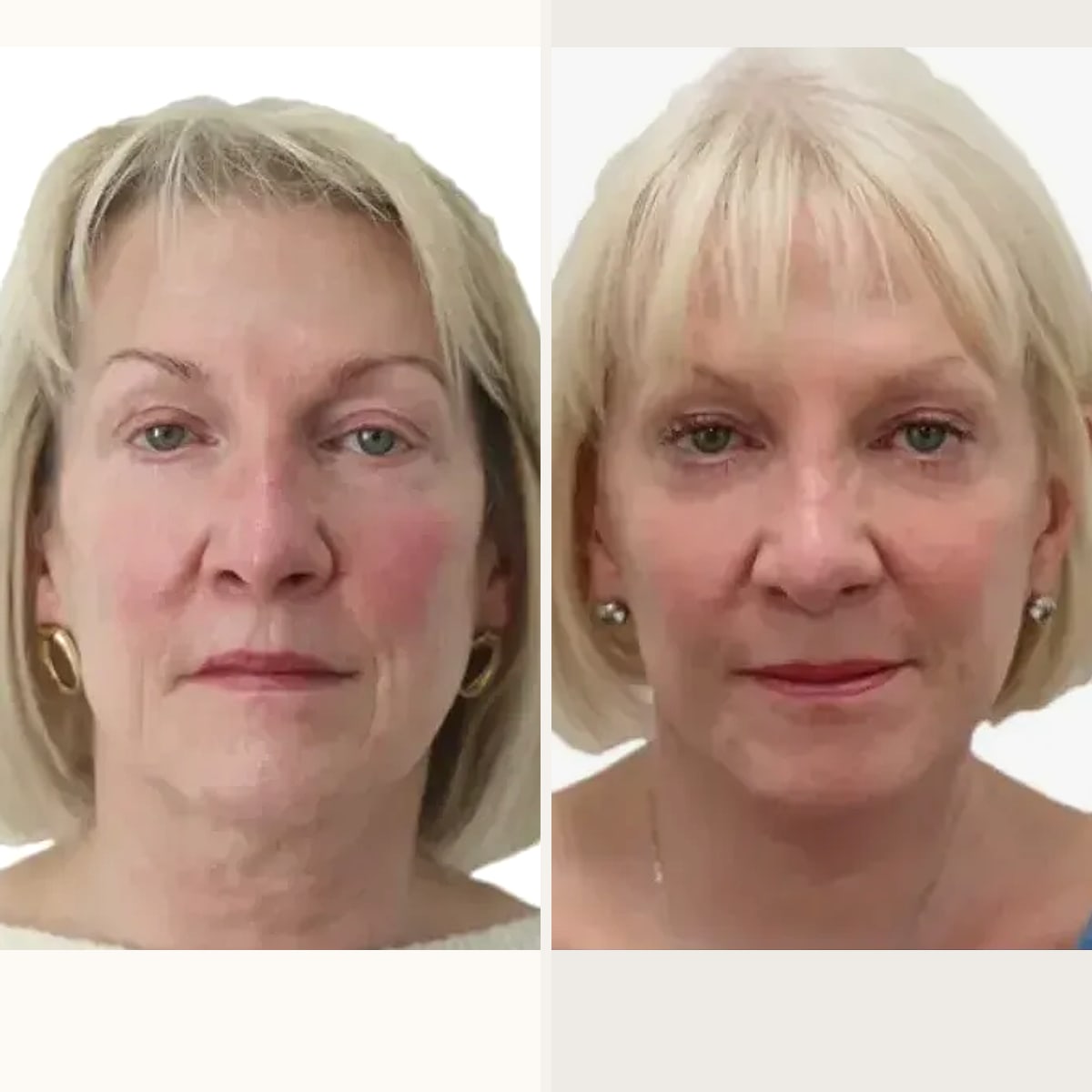 Before and after: Dr. David J. Just
