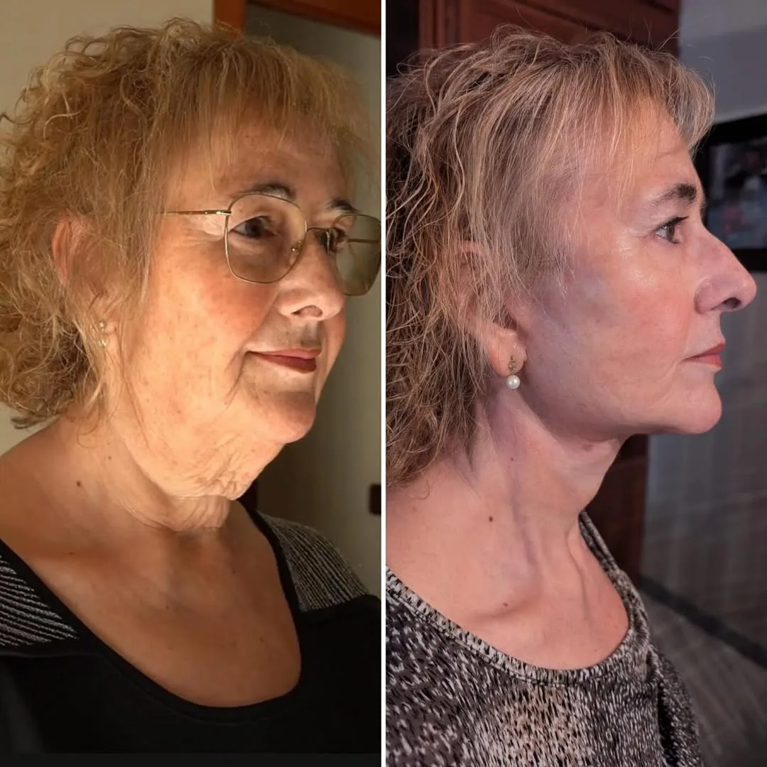 Before and after — Dr. David Neagu