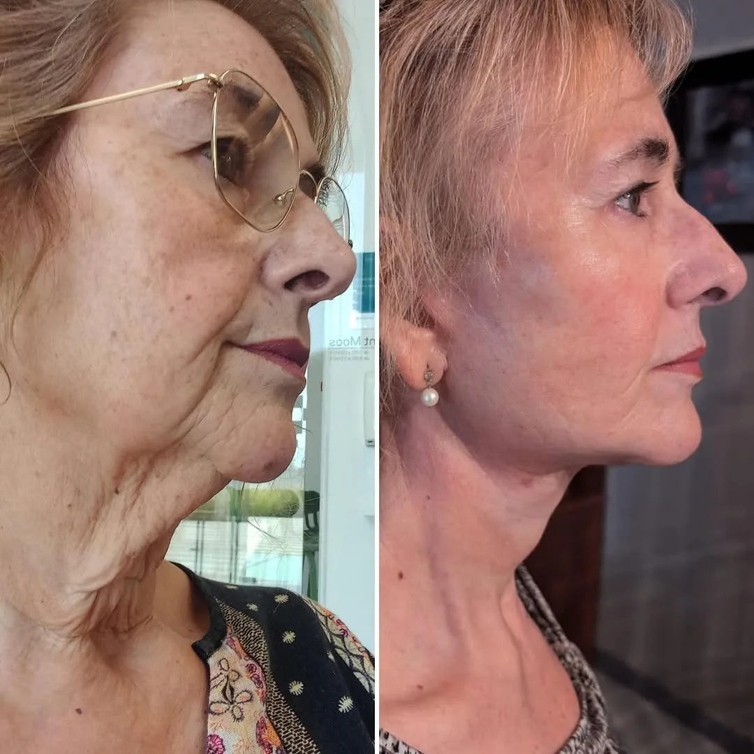 Before and after — Dr. David Neagu