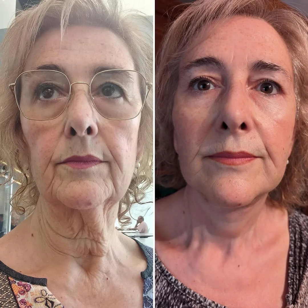Before and after — Dr. David Neagu