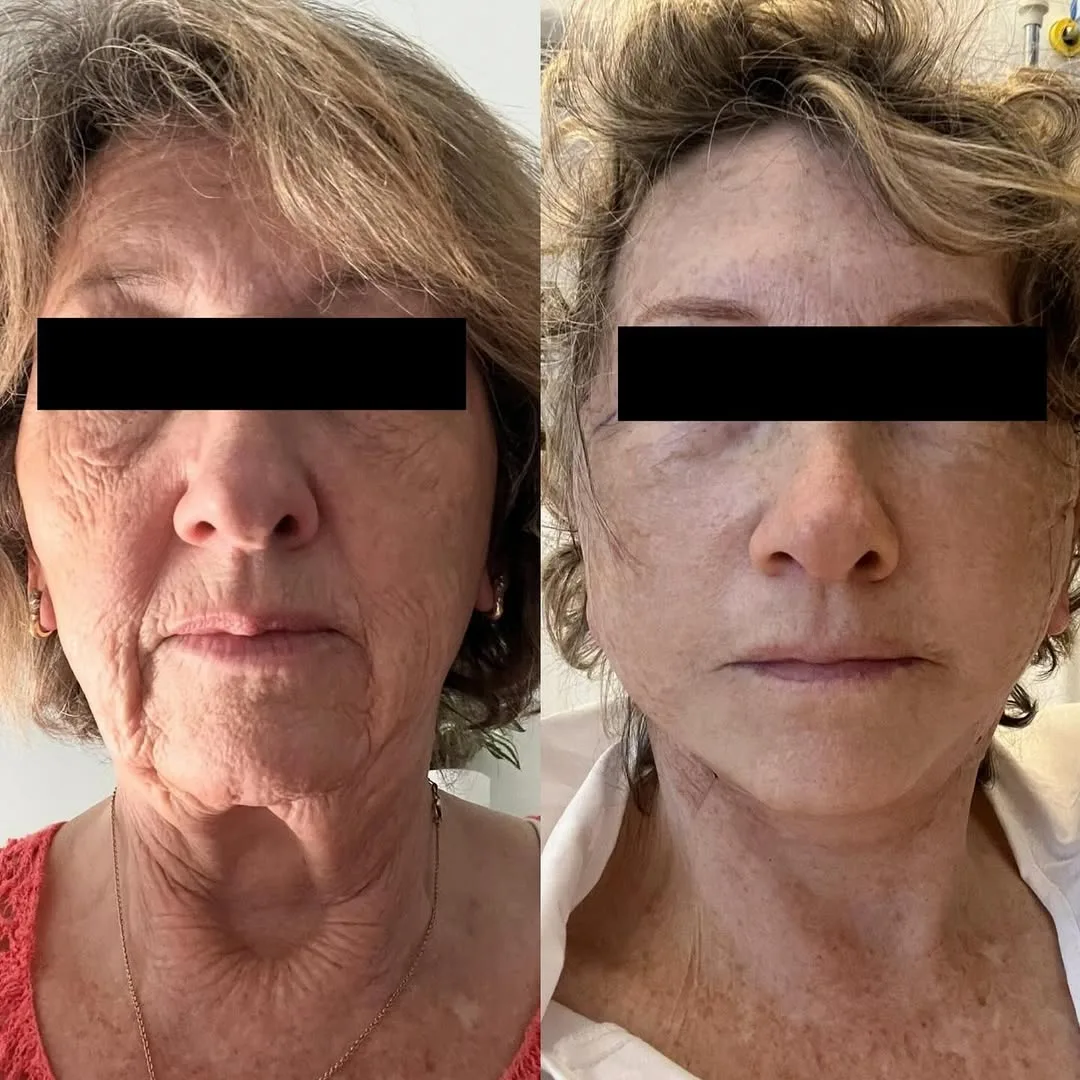 Before and after — Dr. David Neagu